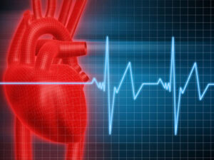 Tachycardia: Symptoms, Causes & Treatment